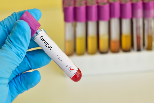 Dengue en embarazadas y menores de 5 años: los síntomas más comunes