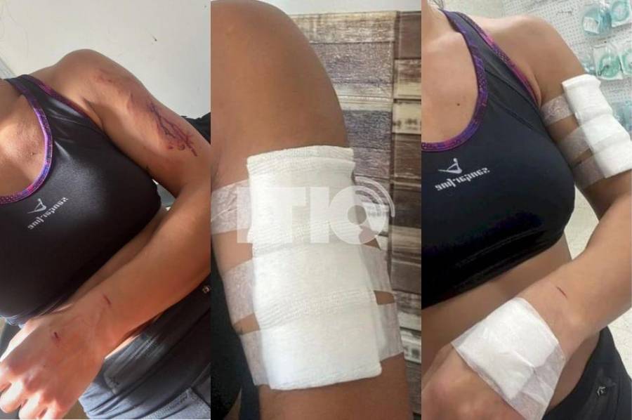 Iba corriendo y fue atacada por un perro en la Ruta 1