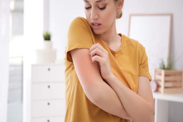 Campaña nacional gratuita para detectar la enfermedad psoriásica