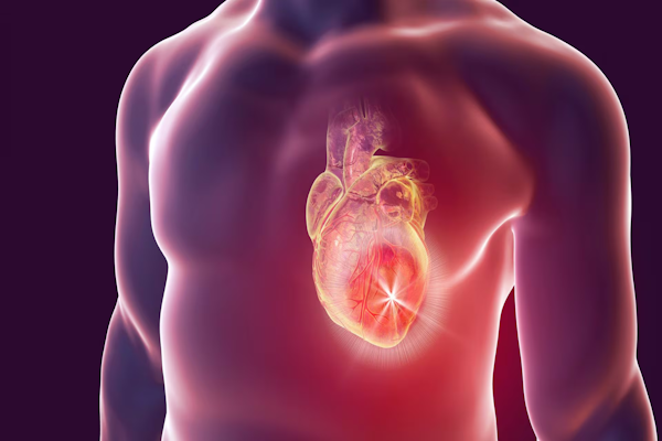 Fiestas de fin de año: cómo prevenir los infartos y ACV